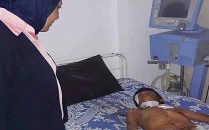 Suriyada 2 uşaq minaya düşərək ölüb, 3-ü yaralanıb