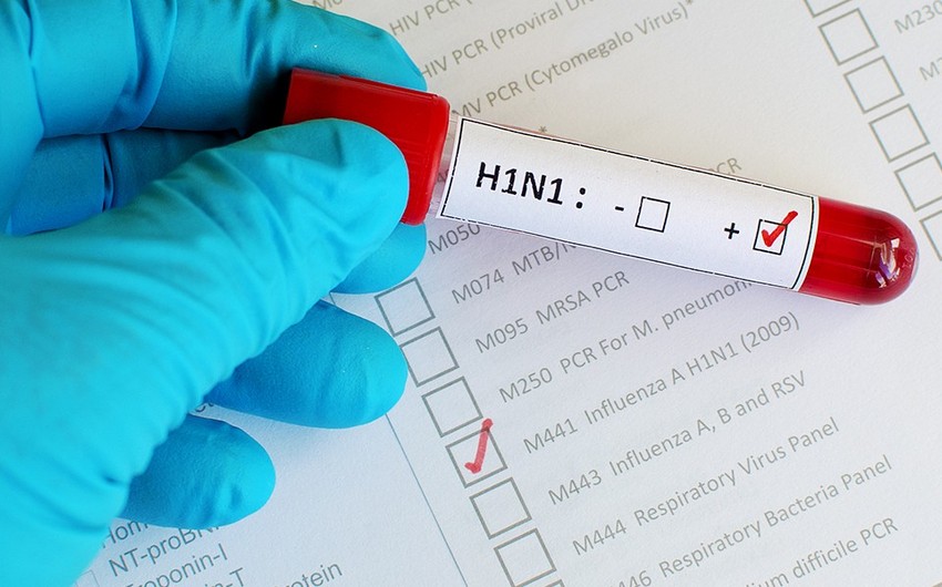 В Грузии зафиксированы два летальных исхода от вируса H1N1