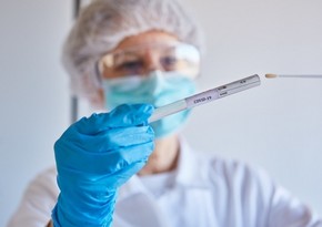 Azərbaycanda daha 1 697 nəfər koronavirusa yoluxub,  13 nəfər ölüb