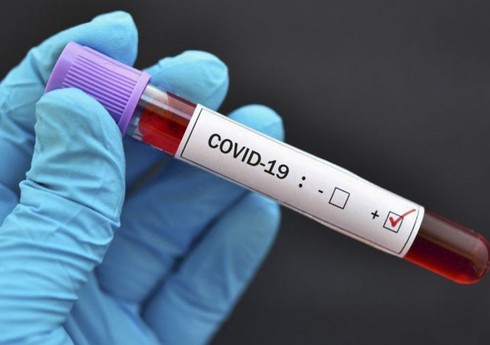 В Грузии за сутки COVID-19 заразились более 3,3 тыс. человек