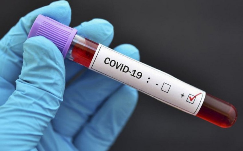 В Грузии за сутки COVID-19 заразились более 3,3 тыс. человек