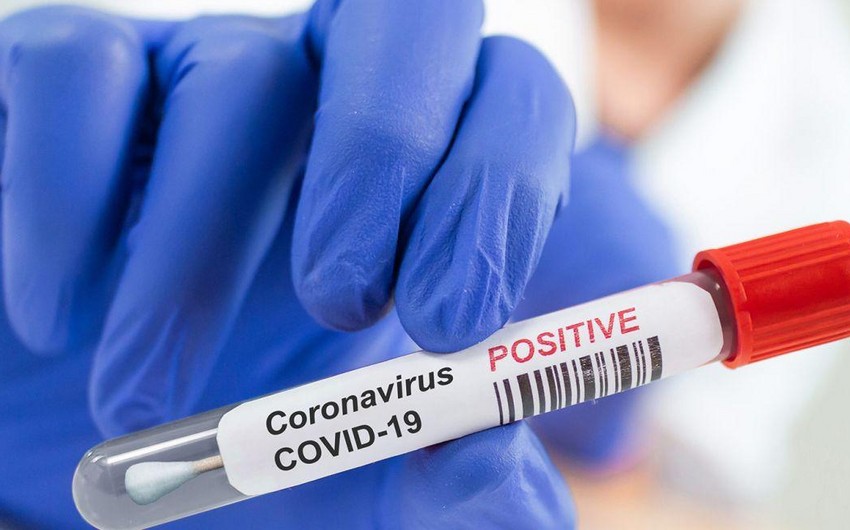 Azərbaycanda daha 1 997 nəfər koronavirusa yoluxub, 31 nəfər ölüb