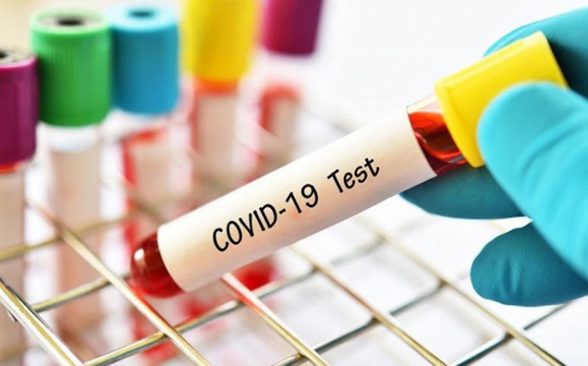 Mütəxəssis koronavirus testlərinin fərqli nəticələr göstərməsinə aydınlıq gətirib