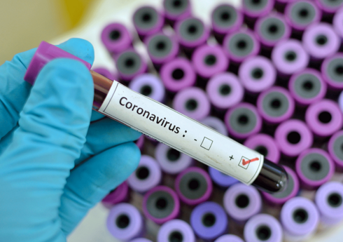 В Азербайджане за сутки выявлено 164 случая заражения коронавирусом, трое скончались