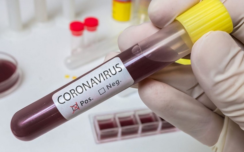 Azerbaijan confirms 75 new coronavirus cases