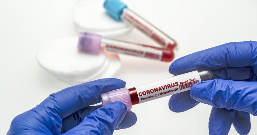 Azerbaijan announces weekly COVID statistics