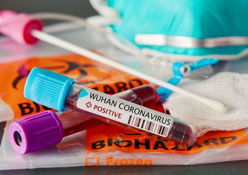 В Азербайджане за сутки два человека заразились коронавирусом