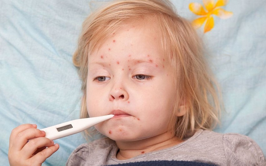 Measles reaches epidemic level in Georgia, population to be vaccinated for free