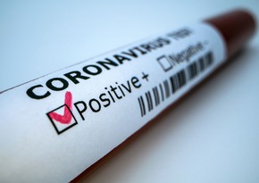 В Азербайджане за сутки три человека заразились коронавирусом, двое скончались