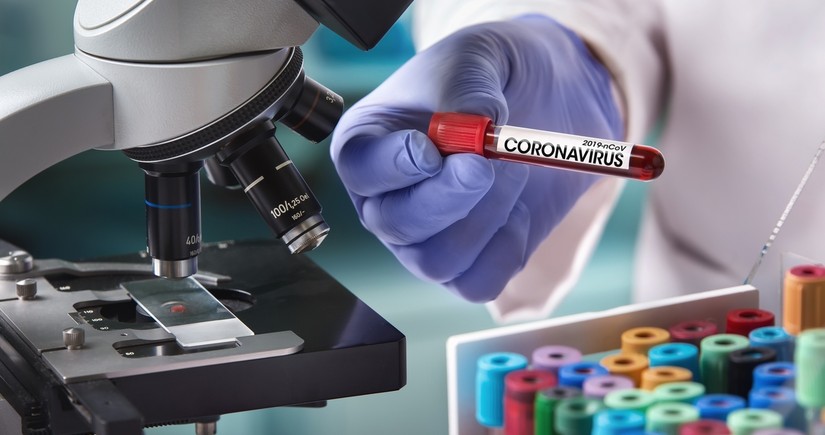 Azerbaijan reports 2 new coronavirus cases, no deaths
