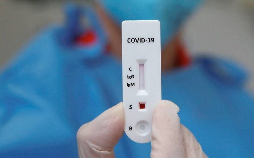 Rusiyalı mikrobioloq alim: “Koronavirus ştamları təxminən hər səkkiz aydan bir dəyişir”