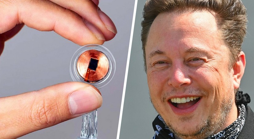 Elon Musk's Neuralink Implants Brain Chip In First Human | Report.az