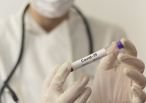 В Азербайджане 133 новых случая заражения коронавирусом