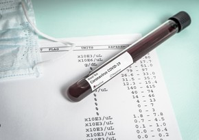 İndoneziyada koronavirus testinin cavabı 3 dəqiqəyə hazır olacaq