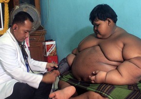 Самый толстый ребенок мира похудел до неузнаваемости