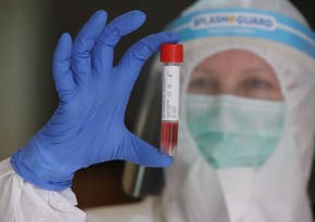 В Азербайджане коронавирусом заразились еще 47 человек