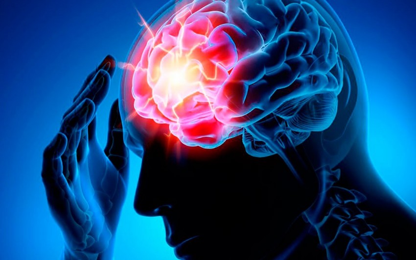 Невролог назвала семь признаков тихого инсульта