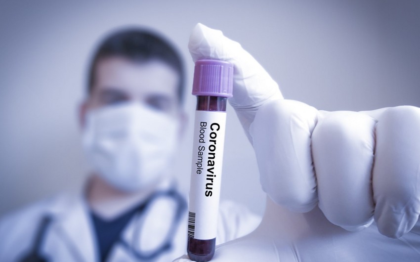 Azərbaycanda daha 321 nəfər koronavirusa yoluxub, 535 nəfər sağalıb