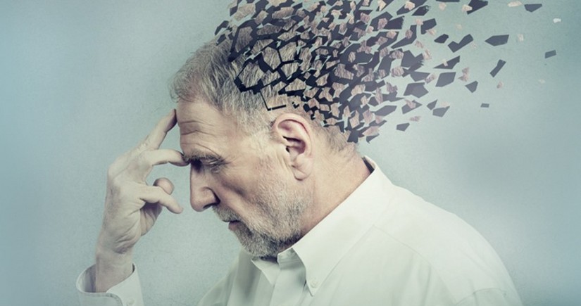 Ученые смогли остановить ухудшение памяти при болезни Альцгеймера