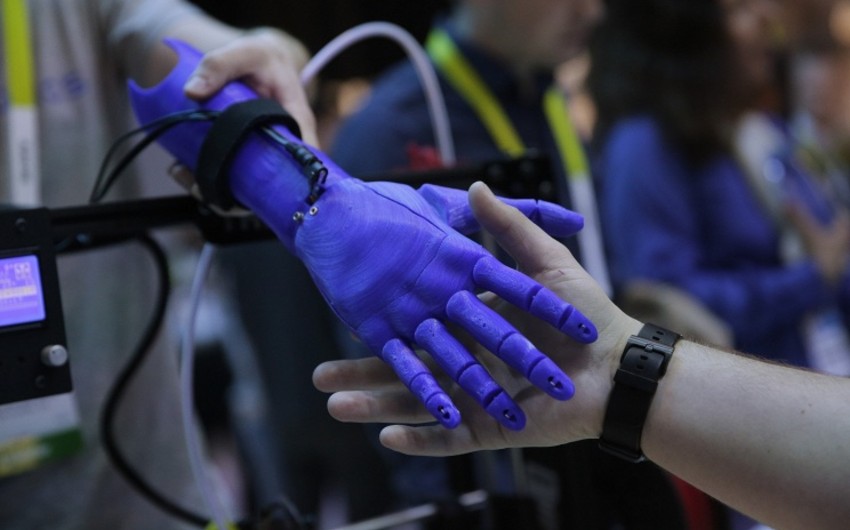 ​Fransada əlil uşağın 3D printer texnologiyası ilə əl protezi çap edilib