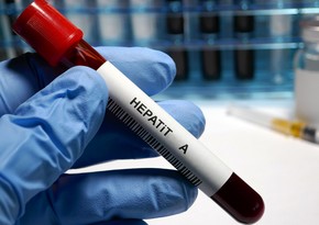 Nazirlik: Azərbaycanda hepatit A virusuna yoluxma halları azalıb, vəziyyət nəzarətdədir