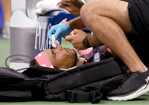 Рафаель Надаль рассек себе нос ракеткой в матче US Open