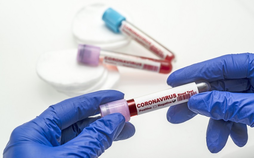 Gürcüstan DTX-nin əməkdaşında koronavirus aşkarlanıb