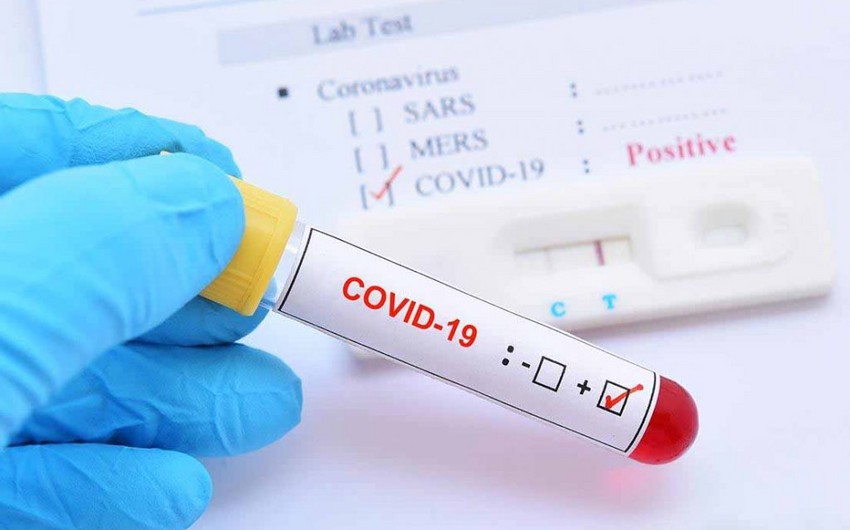 Azərbaycanda daha 1 924 nəfər koronavirusa yoluxub, 23 nəfər ölüb