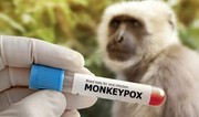 Armenia closes borders to rodents and primates amid monkeypox concerns