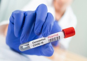 Azərbaycanda koronavirusa daha 2 414 yoluxma qeydə alınıb, 36 nəfər vəfat edib