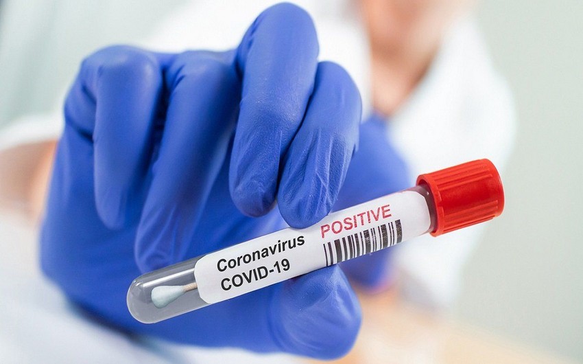 ÜST koronavirus vaksininin təsdiqlənməsi üçün meyarları açıqlayıb