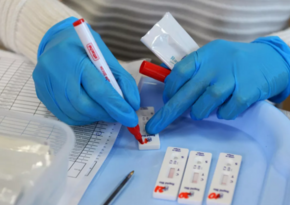 Avstraliya millisinin beş üzvünün koronavirus testi müsbət çıxıb