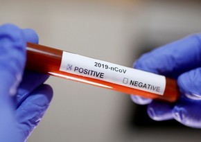 Azərbaycanda son sutkada daha 17 nəfər koronavirusa yoluxub