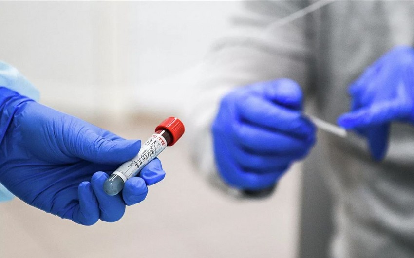 Ölkədə indiyədək 516,5 mindən çox koronavirus testi aparılıb