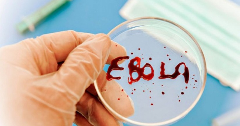 Alimlər ölümcül Ebola qızdırmasının müalicəsində irəliləyiş əldə ediblər