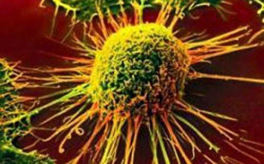 Найден способ состарить раковые опухоли