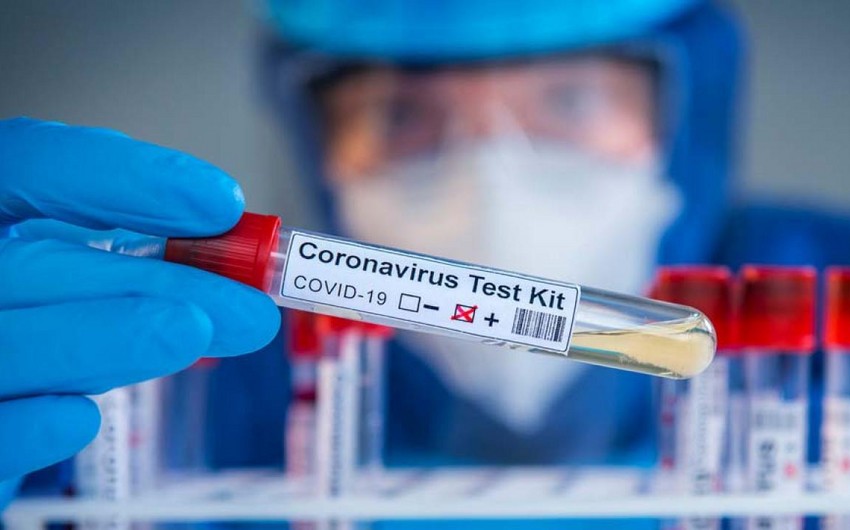 Azərbaycanda daha 168 nəfər koronavirusa yoluxub, 80 nəfər sağalıb, 5 nəfər ölüb