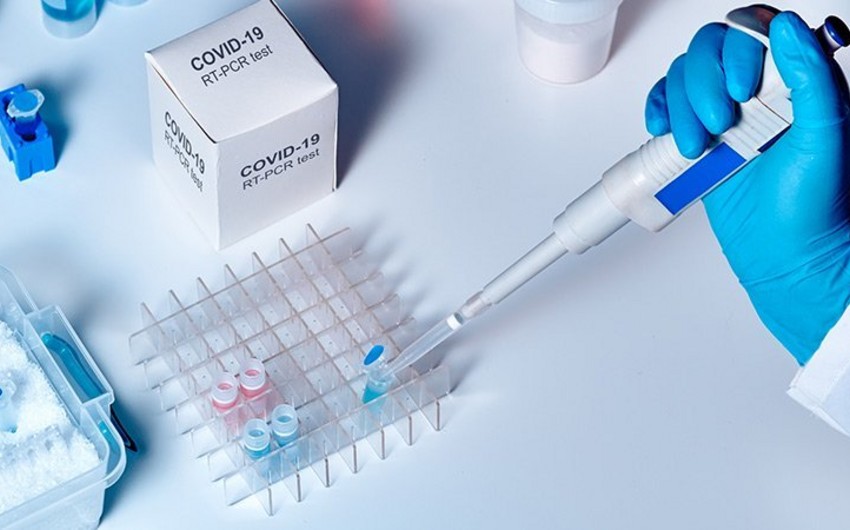 Azərbaycanda koronavirusa görə 86 607 test aparılıb - RƏSMİ