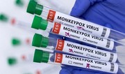 Foreigner with monkeypox symptoms quarantined in Istanbul