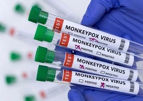 Foreigner with monkeypox symptoms quarantined in Istanbul