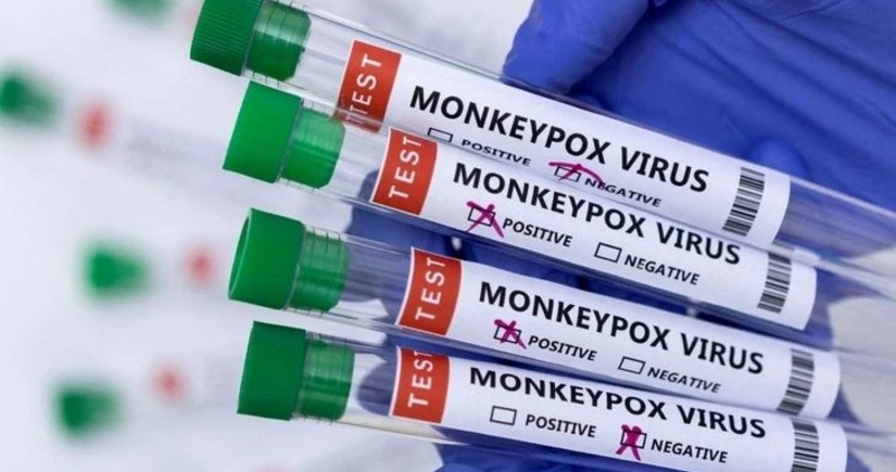 Foreigner with monkeypox symptoms quarantined in Istanbul