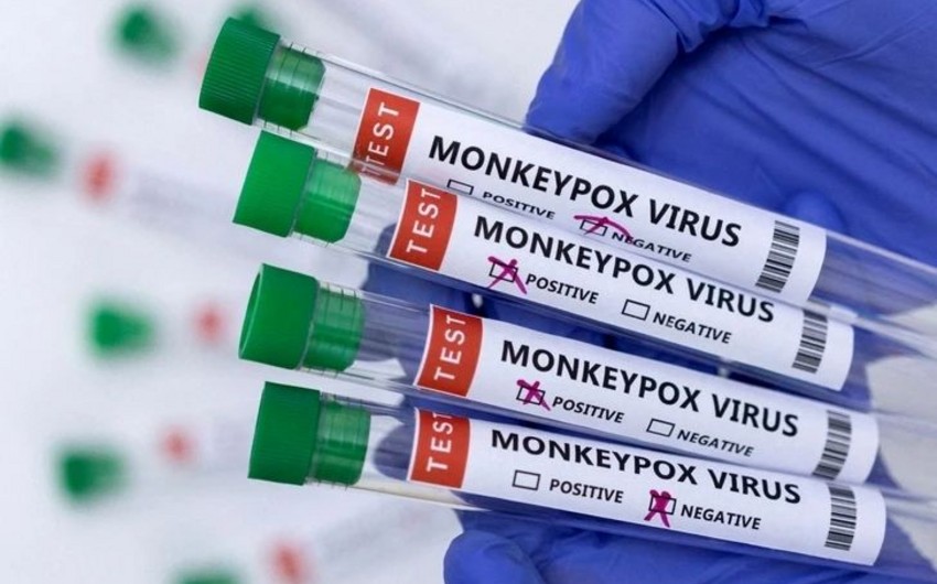 Foreigner with monkeypox symptoms quarantined in Istanbul