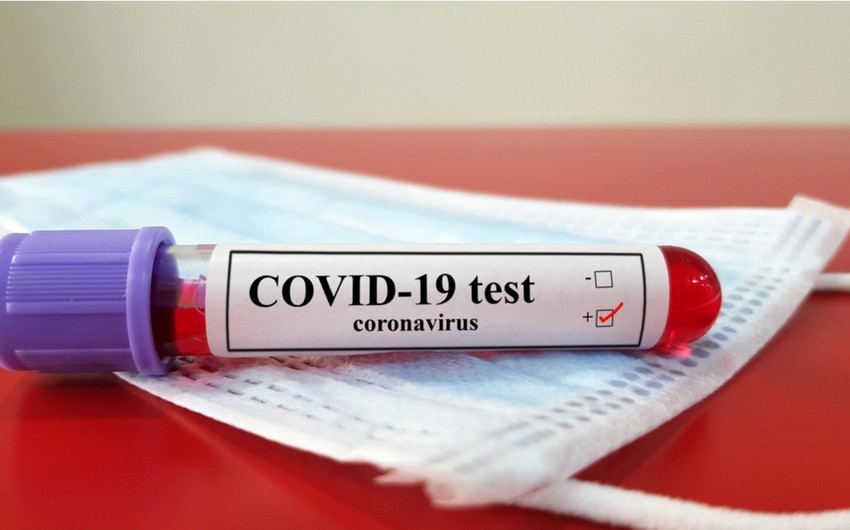 Azərbaycanda koronavirus testlərinin sayı 475 mini keçdi