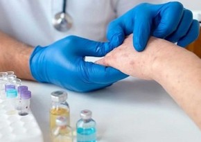 Cases of measles increasing in Azerbaijan - OFFICIAL