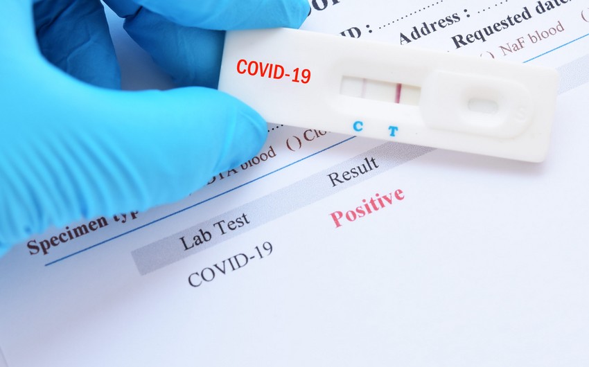 ÜST: Azərbaycanda koronavirusa yoluxma halları azalıb