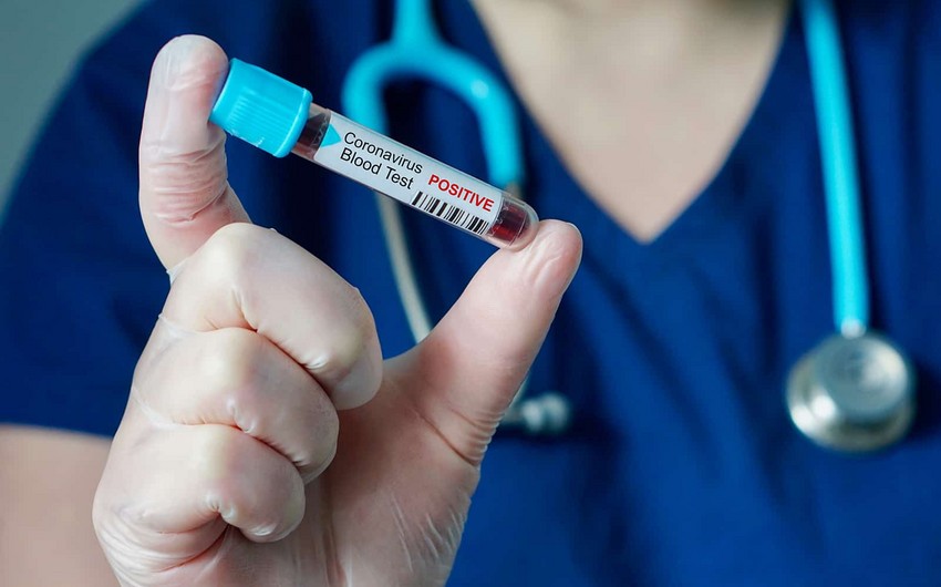 За последние сутки зарегистрировано 65 новых случаев заражения коронавирусом