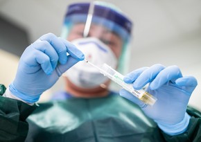 Azərbaycanda daha 9 nəfər koronavirusa yoluxub, ölən olmayıb